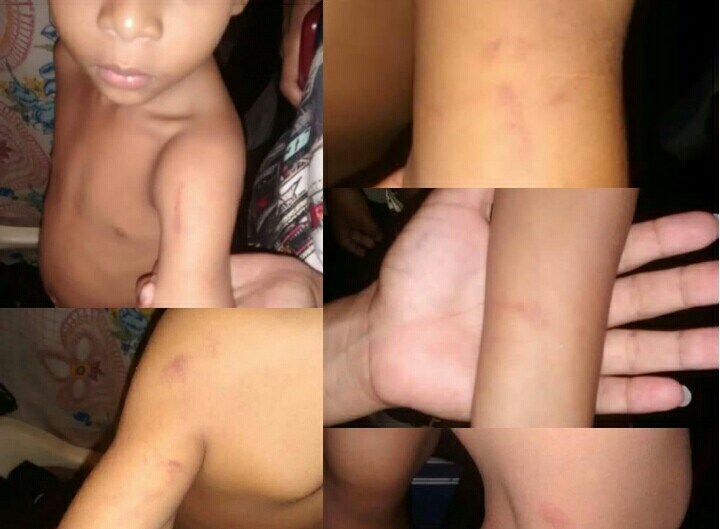 Niño de 5 años habría sido agredido por su profesora porque no dejaba de llorar en clases