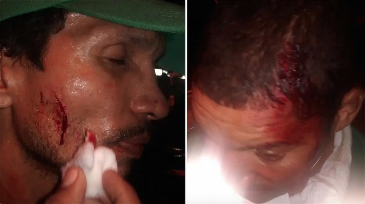 4 vigías y un policía heridos, durante operativos de recuperación del espacio público