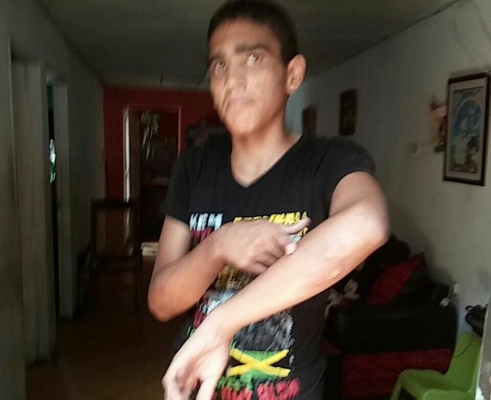 Joven con discapacidad cognitiva se salvó de morir tras ser arrastrado por arroyo de la 21