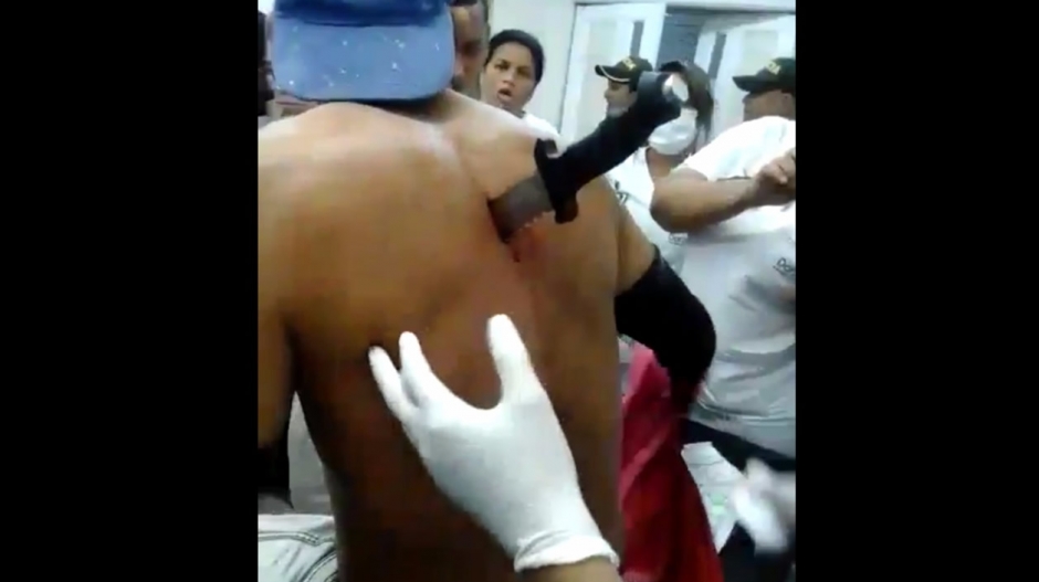 Mototaxista llegó a urgencias con cuchillo clavado en la espalda.