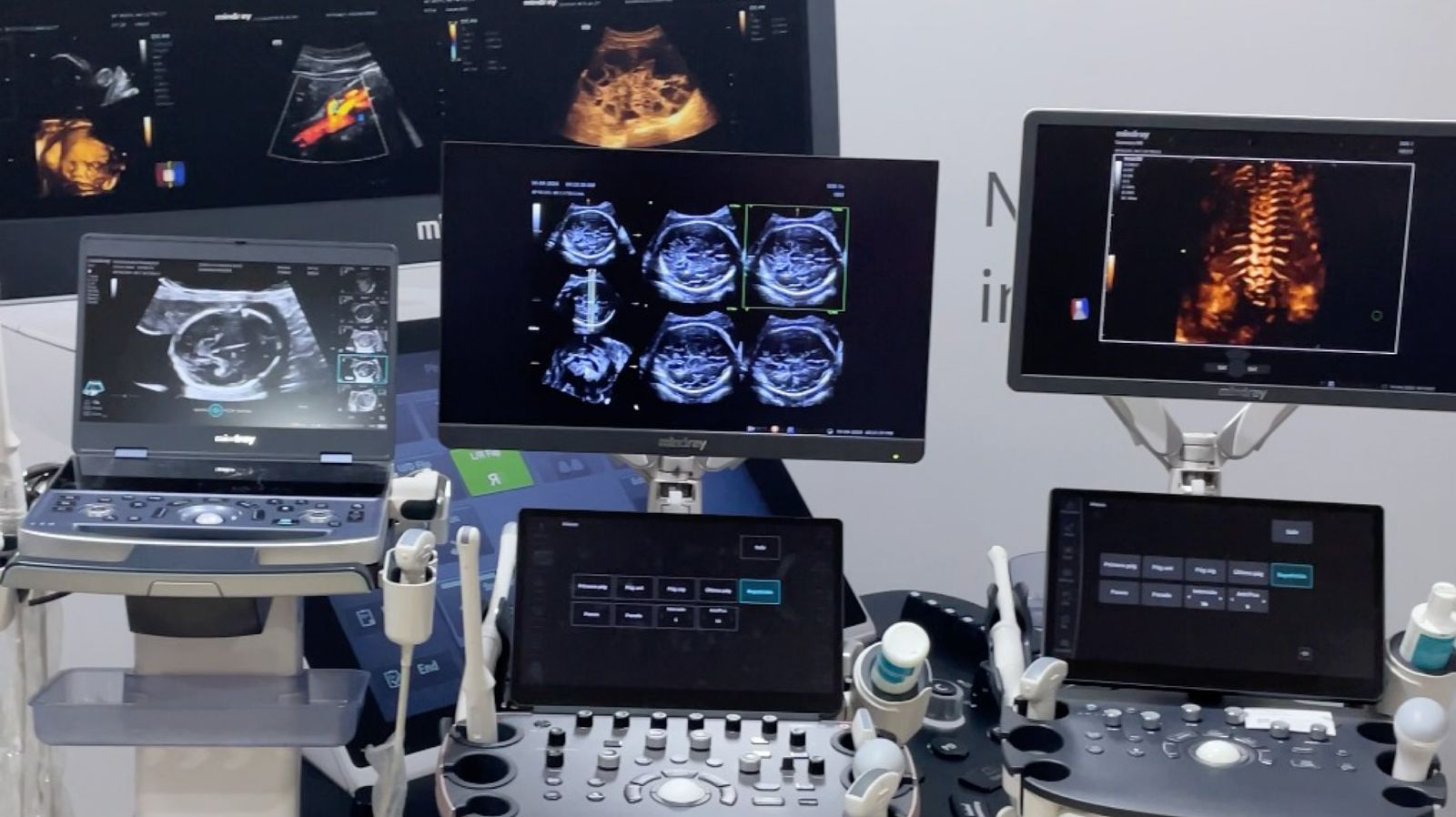 Barranquilla será sede del evento médico que pone a la  Mujer Caribe en el centro de la conversación sobre salud pública