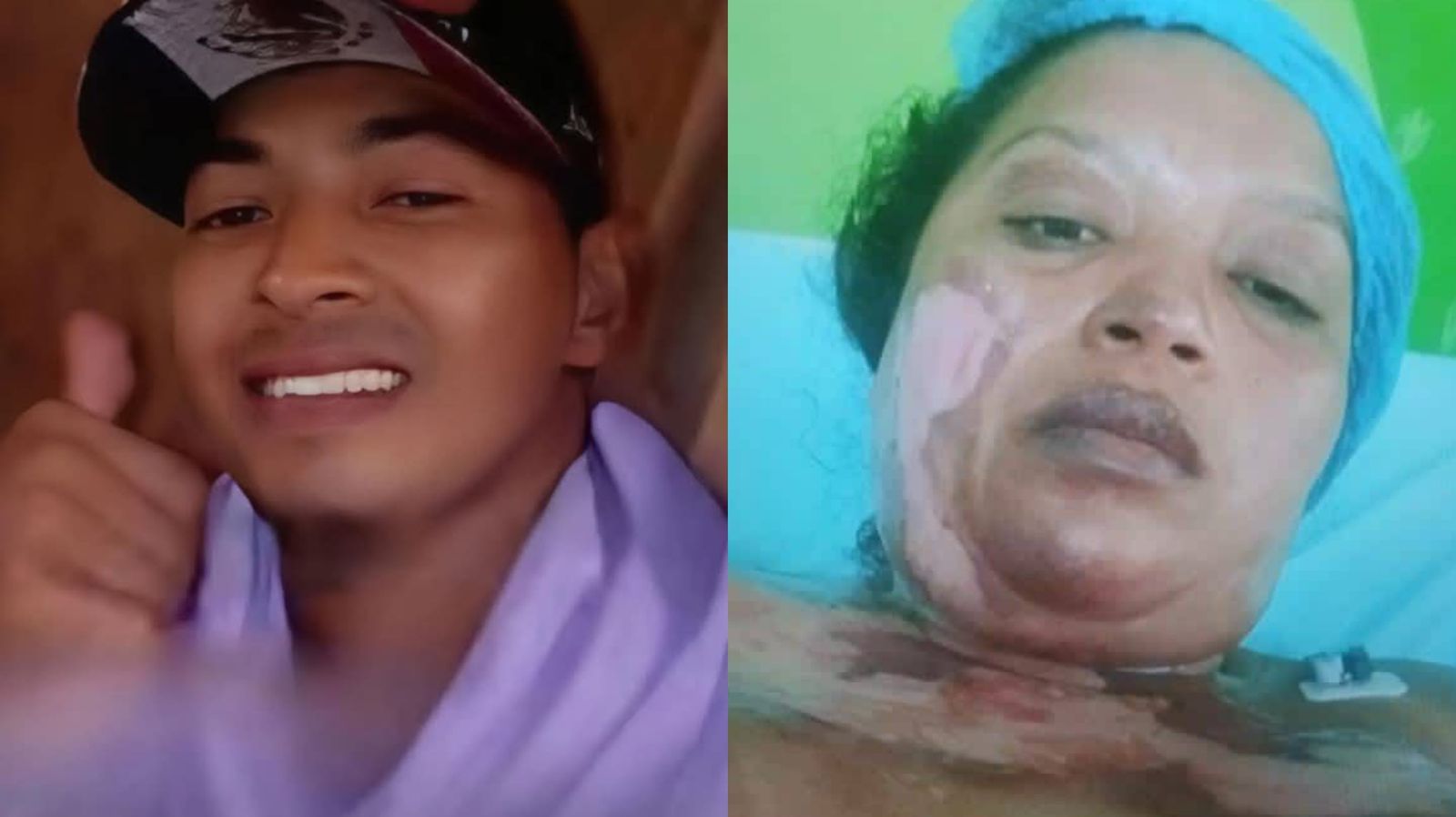 Barranquillero muere tras ser incinerado por su pareja en Bolívar