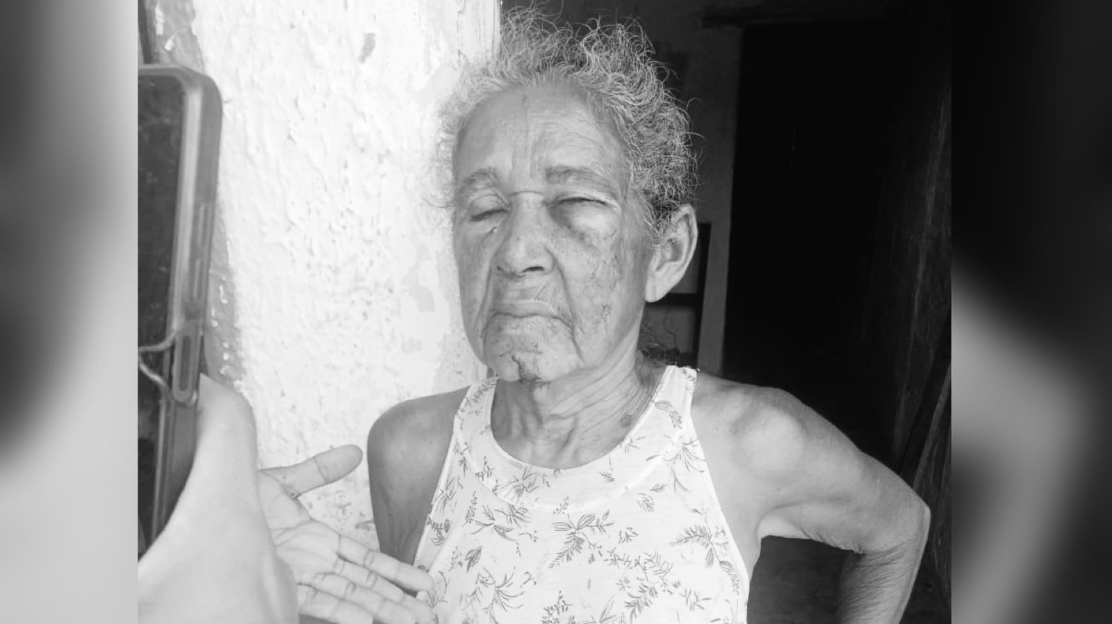 Agreden brutalmente a adulta mayor en barrio Viña de Rey, Soledad