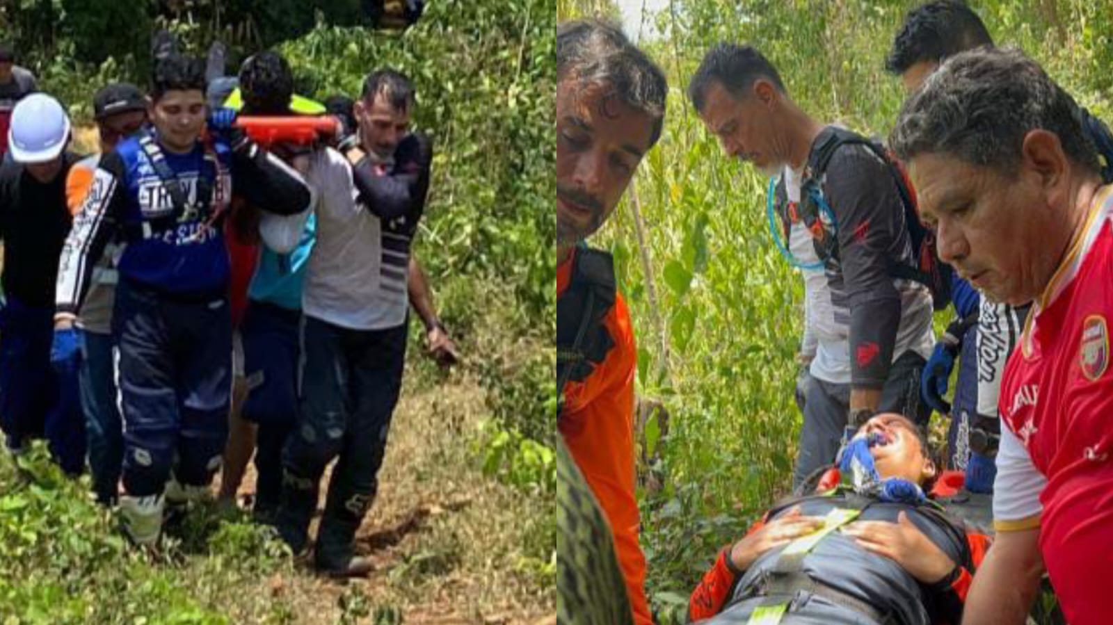 Alcalde de Polonuevo sufre accidente mientras practicaba enduro y será operado por fracturas en la pierna izquierda