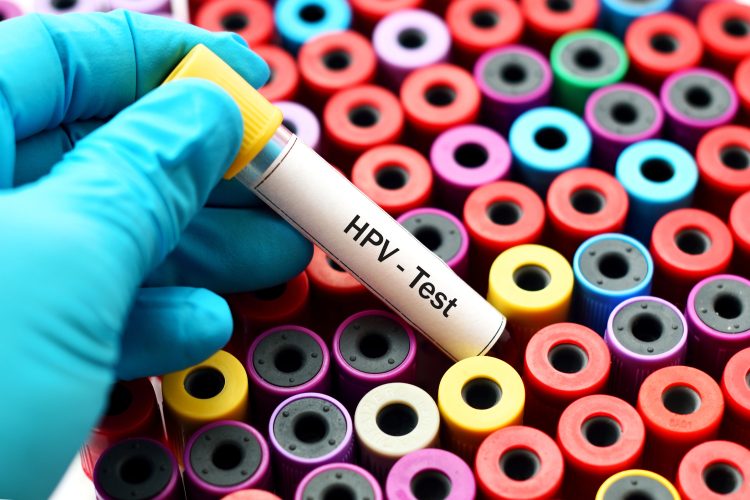 Más de 62.000 pruebas de VPH evidencian la importancia de la vacunación y detección temprana en Colombia